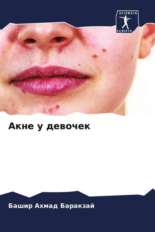 Produktbild: Akne u dewochek