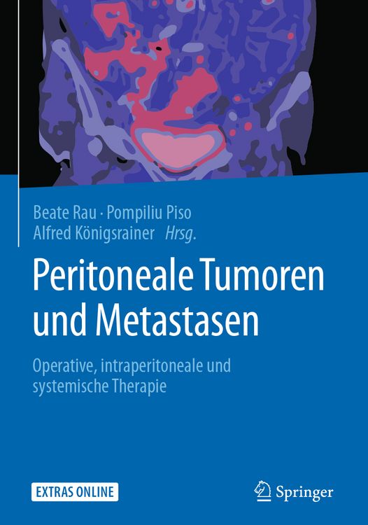 Produktbild: Peritoneale Tumoren und Metastasen