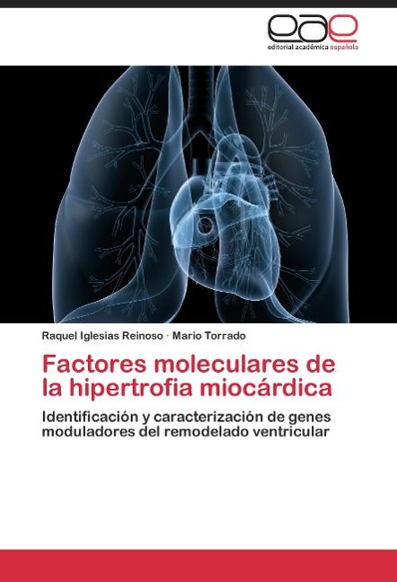 Produktbild: Iglesias Reinoso, R: Factores moleculares de la hipertrofia