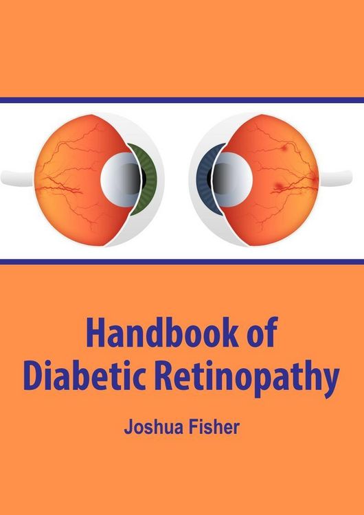 Produktbild: Handbook of Diabetic Retinopathy