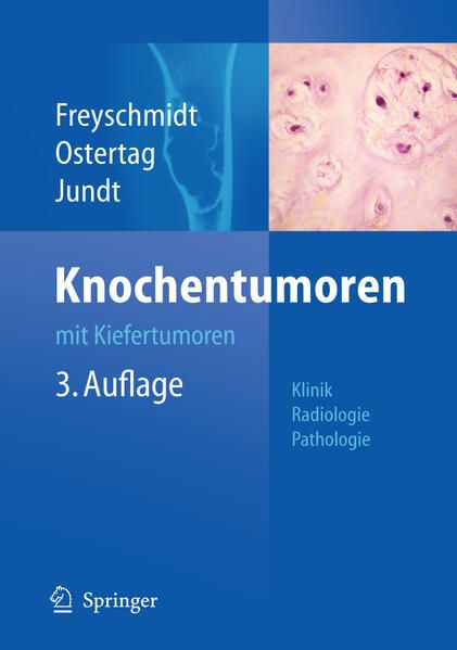 Produktbild: Knochentumoren mit Kiefertumoren
