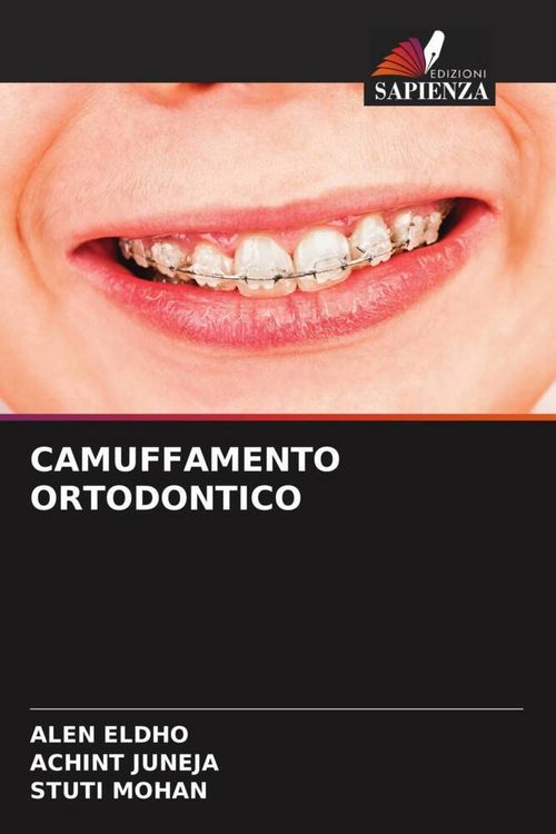 Produktbild: Camuffamento Ortodontico