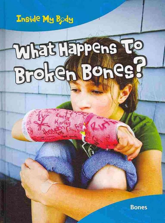 Produktbild: What Happens To Broken Bones