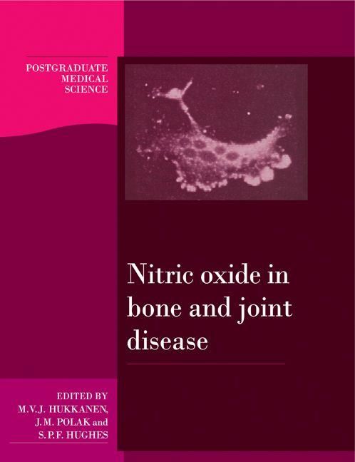 Produktbild: Nitric Oxide in Bone and Joint Disease