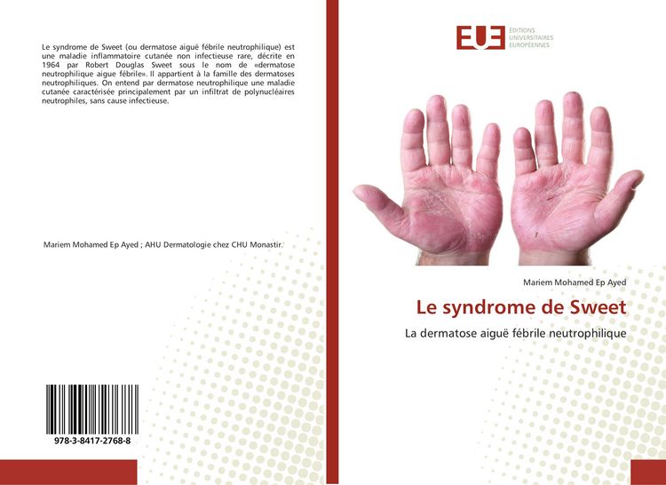 Produktbild: Le syndrome de Sweet