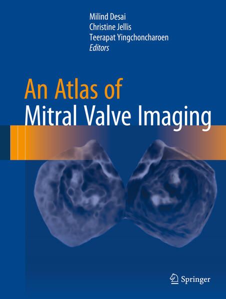 Produktbild: An Atlas of Mitral Valve Imaging