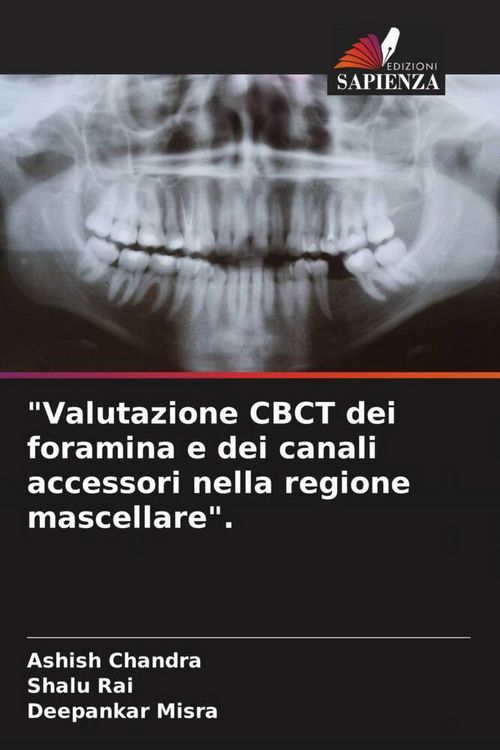 Produktbild: "Valutazione CBCT dei foramina e dei canali accessori nella regione mascellare".