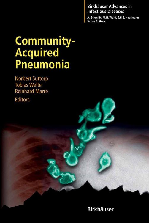 Produktbild: Community-Acquired Pneumonia