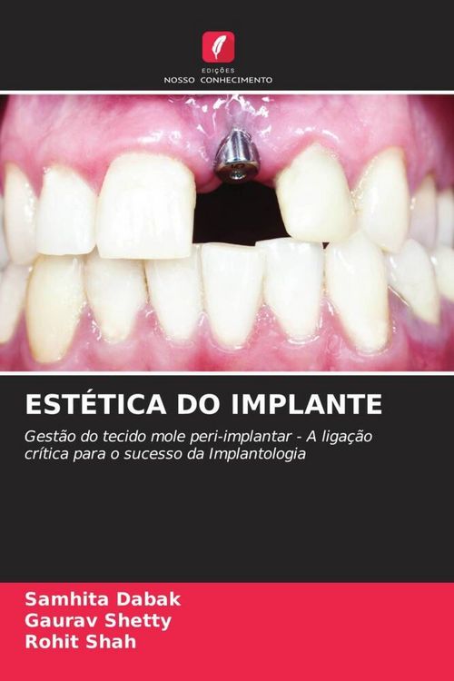 Produktbild: Est&eacute;tica Do Implante