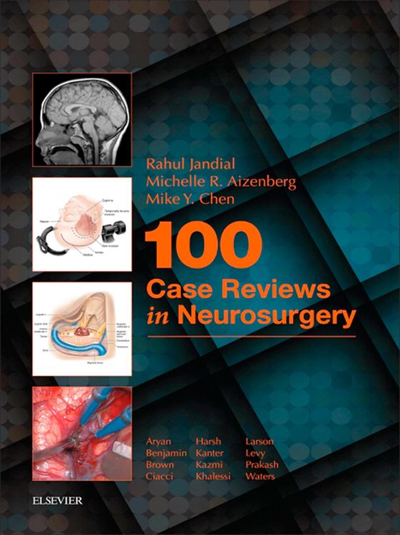 Produktbild: 100 Case Reviews in Neurosurgery E-Book