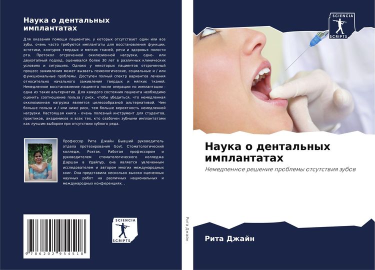 Produktbild: Nauka o dental'nyh implantatah