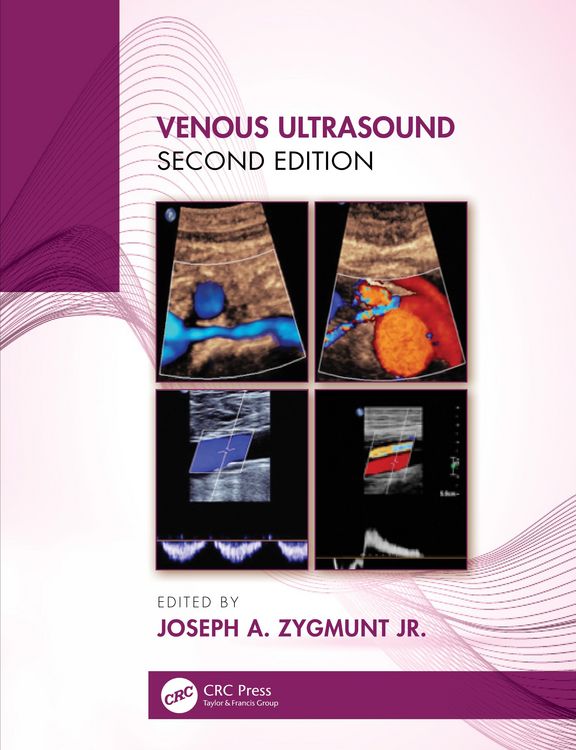 Produktbild: Venous Ultrasound