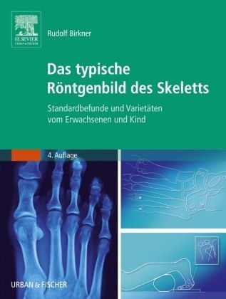 Produktbild: Das typische R&ouml;ntgenbild des Skeletts