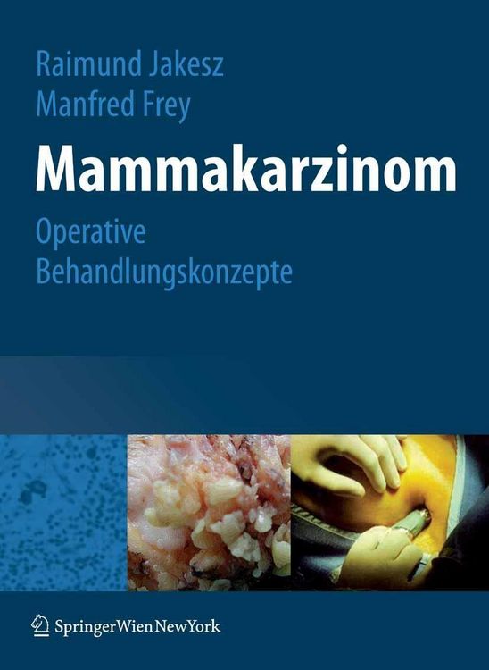 Produktbild: Mammakarzinom