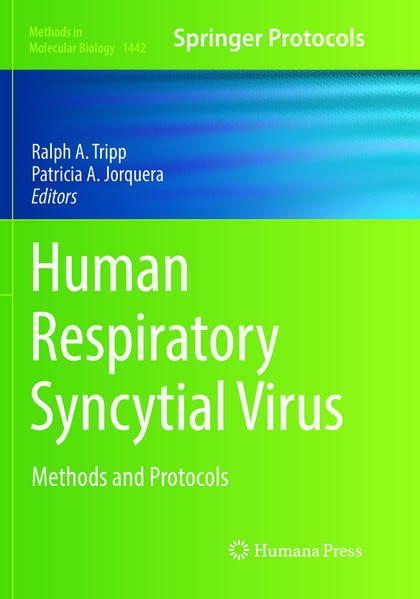 Produktbild: Human Respiratory Syncytial Virus