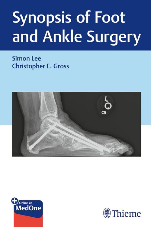 Produktbild: Synopsis of Foot and Ankle Surgery