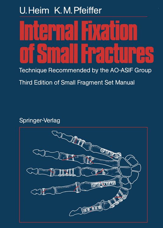 Produktbild: Internal Fixation of Small Fractures
