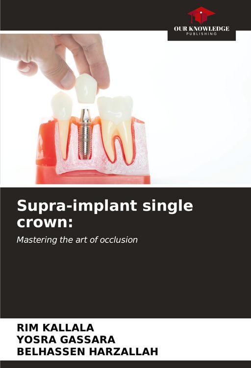 Produktbild: Supra-implant single crown: