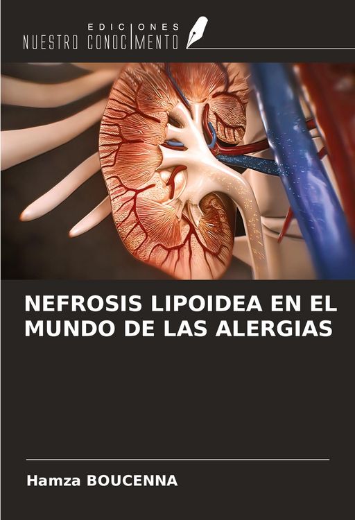 Produktbild: Nefrosis Lipoidea En El Mundo De Las Alergias