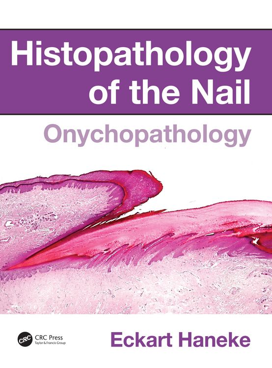 Produktbild: Histopathology of the Nail