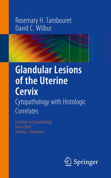 Produktbild: Glandular Lesions of the Uterine Cervix