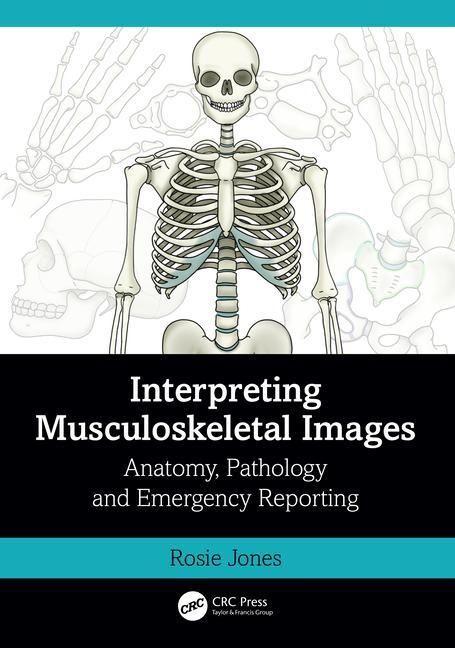 Produktbild: Interpreting Musculoskeletal Images
