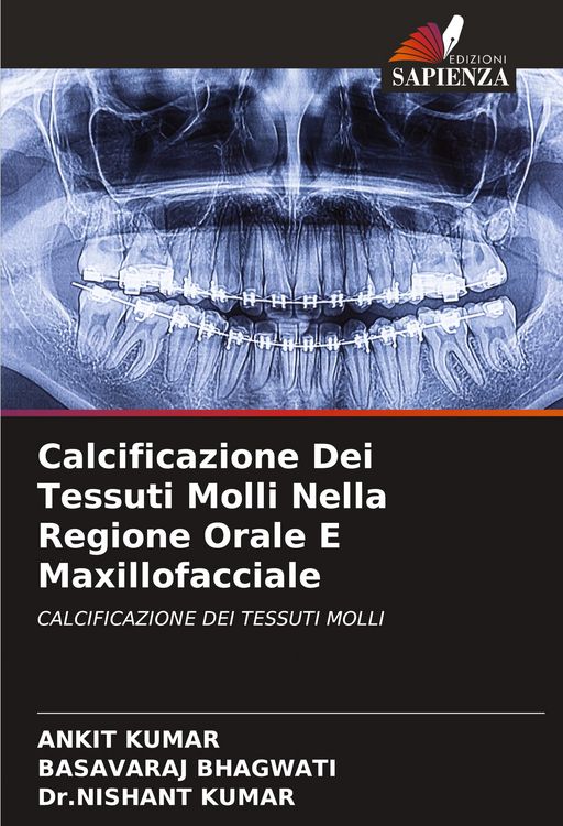 Produktbild: Calcificazione Dei Tessuti Molli Nella Regione Orale E Maxillofacciale