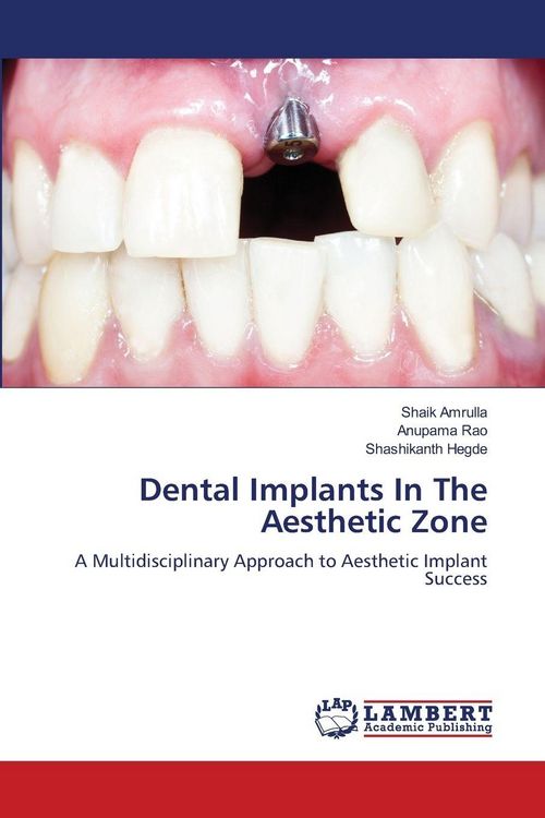Produktbild: Dental Implants In The Aesthetic Zone