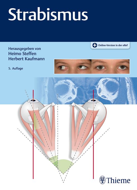 Produktbild: Strabismus