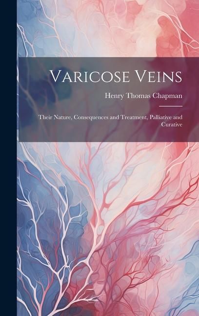 Produktbild: Varicose Veins: Their Nature, Consequences and Treatment, Palliative and Curative