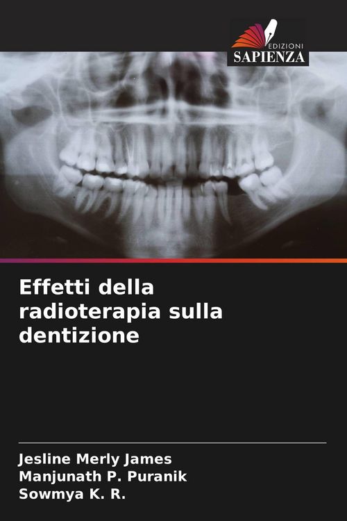 Produktbild: Effetti della radioterapia sulla dentizione