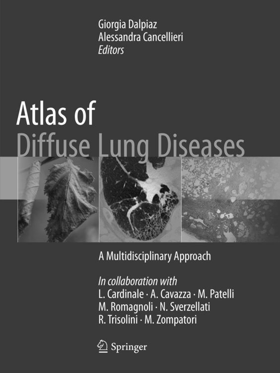 Produktbild: Atlas of Diffuse Lung Diseases
