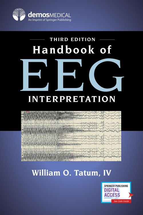 Produktbild: Handbook of EEG Interpretation