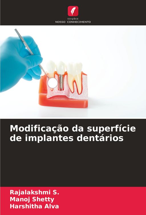 Produktbild: Modifica&ccedil;&atilde;o da superf&iacute;cie de implantes dent&aacute;rios