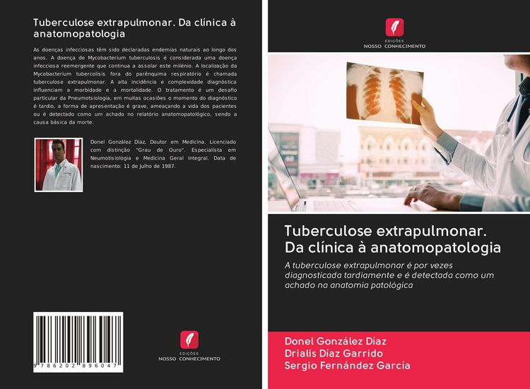 Produktbild: Tuberculose extrapulmonar. Da cl&iacute;nica &agrave; anatomopatologia