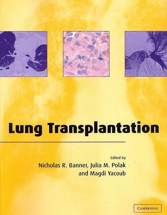 Produktbild: Lung Transplantation
