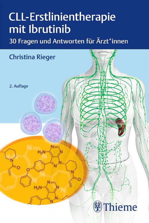 Produktbild: CLL-Erstlinientherapie mit Ibrutinib