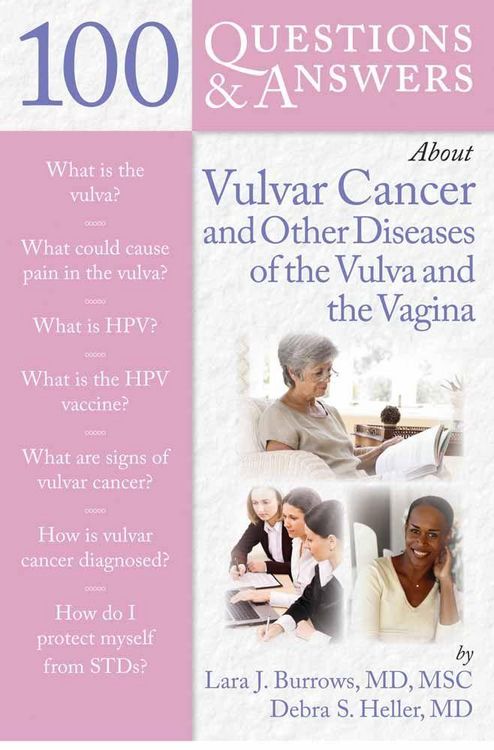 Produktbild: 100 Q&as About Vulvar Cancer & Other Diseases Of Vagina