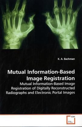 Produktbild: Bachman, K: Mutual Information-Based Image Registration