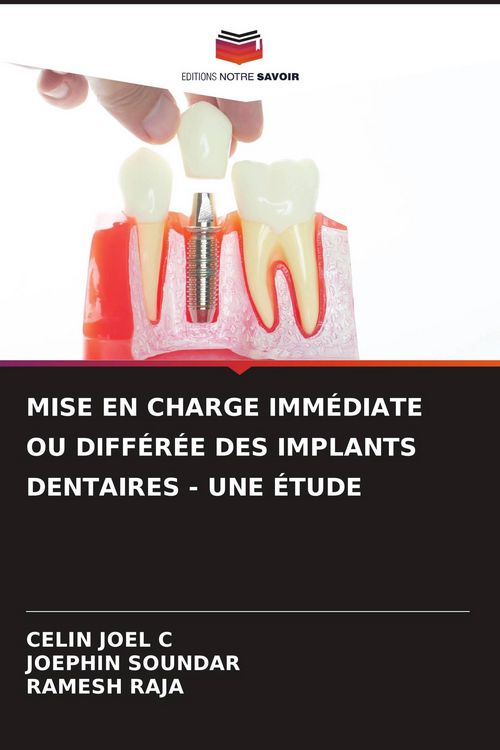 Produktbild: Mise En Charge Imm&eacute;diate Ou Diff&eacute;r&eacute;e des Implants Dentaires - Une &Eacute;tude