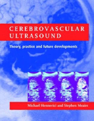 Produktbild: Cerebrovascular Ultrasound