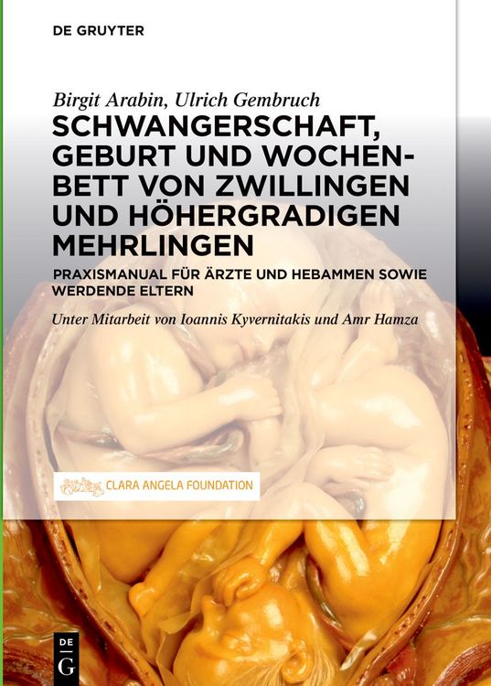 Produktbild: Schwangerschaft, Geburt und Wochenbett von Zwillingen und h&ouml;hergradigen Mehrlingen