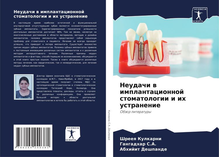 Produktbild: Neudachi w implantacionnoj stomatologii i ih ustranenie