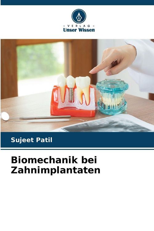 Produktbild: Biomechanik bei Zahnimplantaten