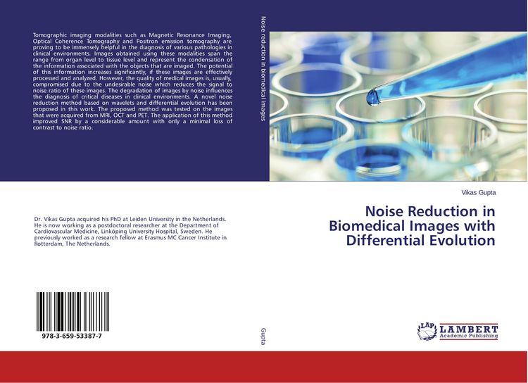 Produktbild: Noise Reduction in Biomedical Images with Differential Evolution