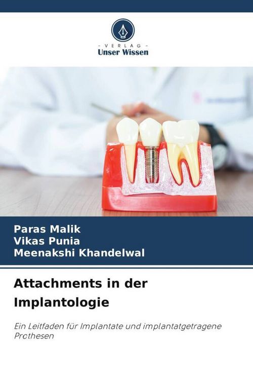 Produktbild: Attachments in der Implantologie