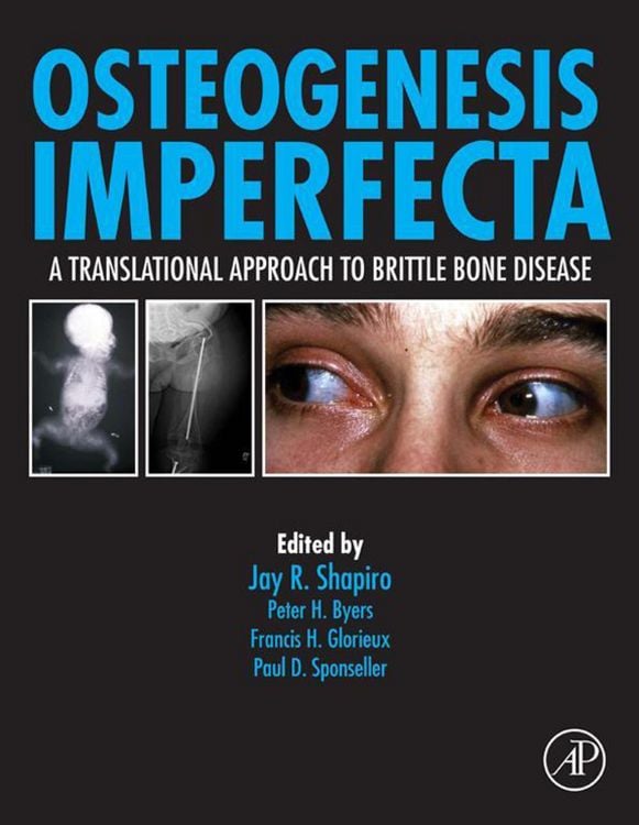 Produktbild: Osteogenesis Imperfecta