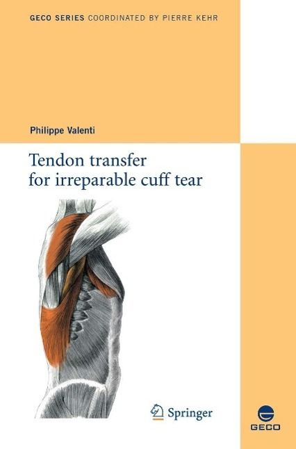 Produktbild: Tendon transfer for irreparable cuff tear