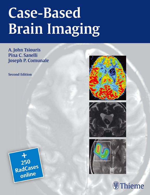 Produktbild: Case-Based Brain Imaging
