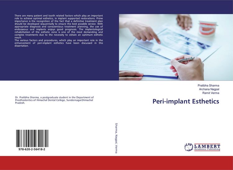 Produktbild: Peri-implant Esthetics